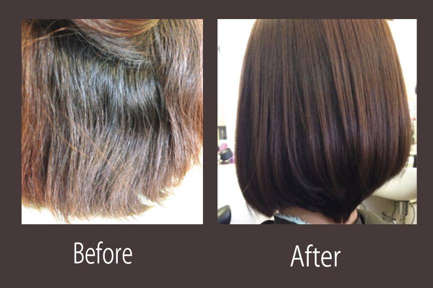 デザイン矯正の丸み仕上がり