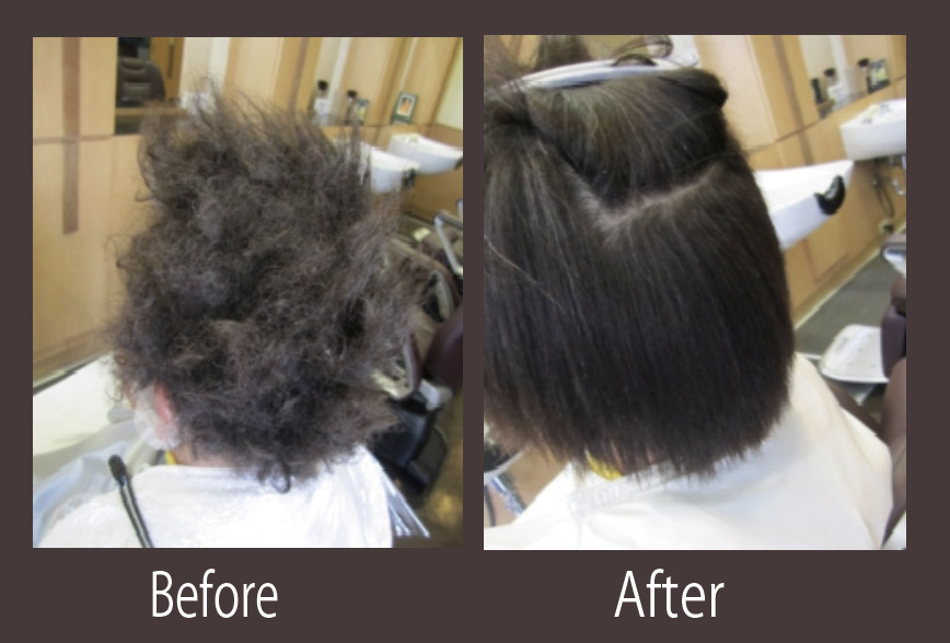 強いくせ毛の矯正事例